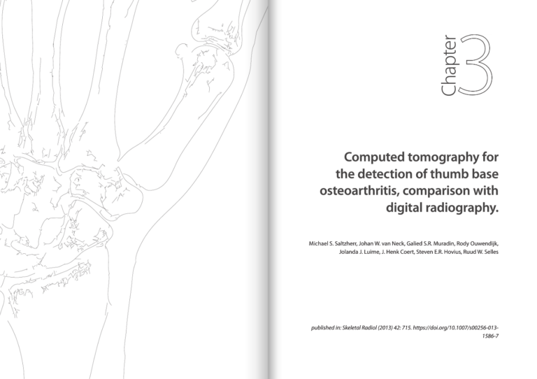 Rheumatoid arthritis treatment options image